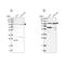 Uncharacterized protein KIAA0753 antibody, NBP1-90929, Novus Biologicals, Western Blot image 