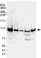 RAD21 Cohesin Complex Component antibody, ab992, Abcam, Western Blot image 