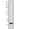 Putative cystatin-9-like 2 antibody, abx149679, Abbexa, Western Blot image 