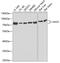 Hyaluronan Synthase 3 antibody, 22-355, ProSci, Western Blot image 