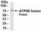 V-type proton ATPase subunit E 1 antibody, XW-8013, ProSci, Western Blot image 