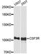 Colony Stimulating Factor 3 Receptor antibody, STJ29974, St John