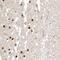 Proteasome 26S Subunit, Non-ATPase 6 antibody, PA5-57871, Invitrogen Antibodies, Immunohistochemistry paraffin image 