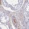 TNF Alpha Induced Protein 6 antibody, NBP2-38637, Novus Biologicals, Immunohistochemistry paraffin image 