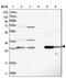 Phospholipid Phosphatase 3 antibody, NBP1-82825, Novus Biologicals, Western Blot image 