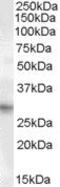 Paired Related Homeobox 1 antibody, PA5-18831, Invitrogen Antibodies, Western Blot image 