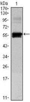 Paired Box 6 antibody, NBP1-51622, Novus Biologicals, Western Blot image 