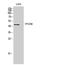 VPS26, Retromer Complex Component B antibody, A12325, Boster Biological Technology, Western Blot image 