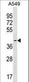 Signal Regulatory Protein Beta 1 antibody, LS-C158971, Lifespan Biosciences, Western Blot image 