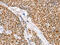 Interferon Regulatory Factor 6 antibody, CSB-PA287048, Cusabio, Immunohistochemistry paraffin image 