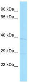 Wnt Family Member 11 antibody, TA344070, Origene, Western Blot image 