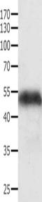 Actin Gamma 1 antibody, orb518307, Biorbyt, Western Blot image 