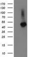 Tubulin Folding Cofactor E Like antibody, TA502645S, Origene, Western Blot image 