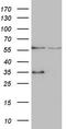 Vacuolar Protein Sorting 13 Homolog B antibody, TA807801, Origene, Western Blot image 