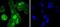Cyclin A2 antibody, A00700-2, Boster Biological Technology, Immunocytochemistry image 