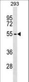 Zinc Finger And BTB Domain Containing 6 antibody, LS-C157396, Lifespan Biosciences, Western Blot image 