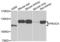 Phosphatidylinositol-4,5-Bisphosphate 3-Kinase Catalytic Subunit Alpha antibody, LS-C330883, Lifespan Biosciences, Western Blot image 