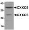 CXXC Finger Protein 5 antibody, A06865, Boster Biological Technology, Western Blot image 