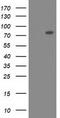 Oxysterol Binding Protein Like 11 antibody, TA501938, Origene, Western Blot image 