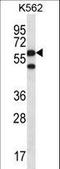 Chaperonin Containing TCP1 Subunit 8 antibody, LS-C168503, Lifespan Biosciences, Western Blot image 