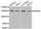 Scaffold Attachment Factor B2 antibody, LS-C333239, Lifespan Biosciences, Western Blot image 