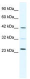 E2F-1 antibody, TA330374, Origene, Western Blot image 
