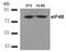 Eukaryotic Translation Initiation Factor 4B antibody, 79-421, ProSci, Western Blot image 