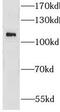 Glutamate Ionotropic Receptor Delta Type Subunit 1 antibody, FNab03647, FineTest, Western Blot image 