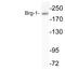 SWI/SNF Related, Matrix Associated, Actin Dependent Regulator Of Chromatin, Subfamily A, Member 4 antibody, LS-C199777, Lifespan Biosciences, Western Blot image 