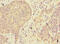 Abhydrolase Domain Containing 2 antibody, CSB-PA001094LA01HU, Cusabio, Immunohistochemistry frozen image 