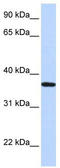 Lipocalin 12 antibody, TA344317, Origene, Western Blot image 