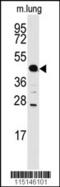 Acid Phosphatase, Prostate antibody, 63-019, ProSci, Western Blot image 
