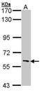 Interleukin 1 Receptor Associated Kinase 3 antibody, PA5-21559, Invitrogen Antibodies, Western Blot image 