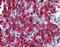 Cbl Proto-Oncogene C antibody, AP07527PU-N, Origene, Immunohistochemistry paraffin image 