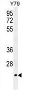 Transcription Elongation Factor A Like 3 antibody, AP54195PU-N, Origene, Western Blot image 