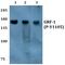 Rho GTPase Activating Protein 35 antibody, PA5-36713, Invitrogen Antibodies, Western Blot image 