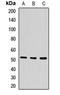 Peroxisome Proliferator Activated Receptor Alpha antibody, LS-C667954, Lifespan Biosciences, Western Blot image 