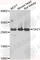 Ornithine Decarboxylase Antizyme 1 antibody, A7444, ABclonal Technology, Western Blot image 