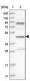 VPS37A Subunit Of ESCRT-I antibody, PA5-55160, Invitrogen Antibodies, Western Blot image 