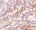 Carcinoembryonic Antigen Related Cell Adhesion Molecule 5 antibody, V2089IHC-7ML, NSJ Bioreagents, Immunohistochemistry frozen image 