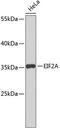 Eukaryotic Translation Initiation Factor 2A antibody, 19-524, ProSci, Western Blot image 