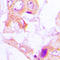 Acetyl-CoA Carboxylase Alpha antibody, LS-C368566, Lifespan Biosciences, Immunohistochemistry paraffin image 