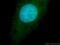 RNA Binding Motif Protein 26 antibody, 16823-1-AP, Proteintech Group, Immunofluorescence image 