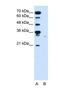 Solute Carrier Family 22 Member 7 antibody, NBP1-69691, Novus Biologicals, Western Blot image 