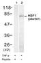Heat Shock Transcription Factor 1 antibody, GTX79052, GeneTex, Western Blot image 