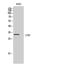 Calcium And Integrin Binding Family Member 3 antibody, STJ92291, St John