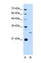 Aspartate Beta-Hydroxylase antibody, NBP1-69230, Novus Biologicals, Western Blot image 