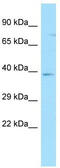 G Protein-Coupled Receptor 35 antibody, TA338286, Origene, Western Blot image 