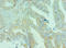 Bromodomain Containing 9 antibody, LS-C380124, Lifespan Biosciences, Immunohistochemistry paraffin image 