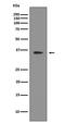 Sirtuin 2 antibody, M00433-1, Boster Biological Technology, Western Blot image 
